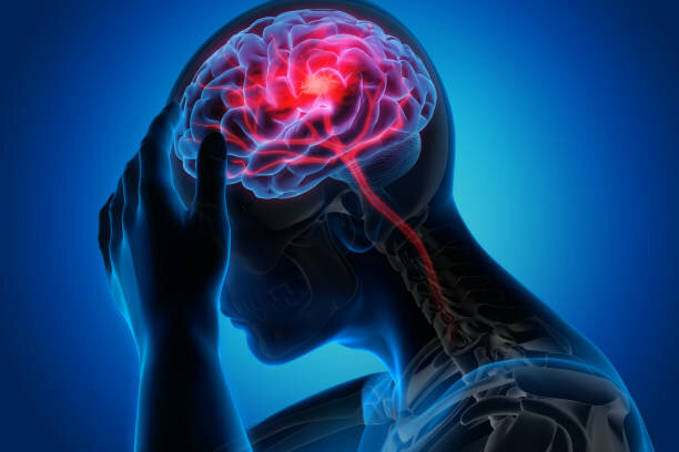 Stroke | Dr. Sujit Jagtap